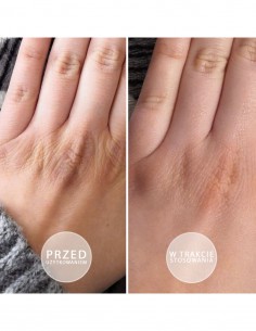 S.O.S – intensivt fetende... 2