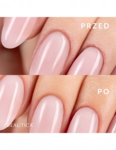 S.O.S - Dry Oil 15ml 2